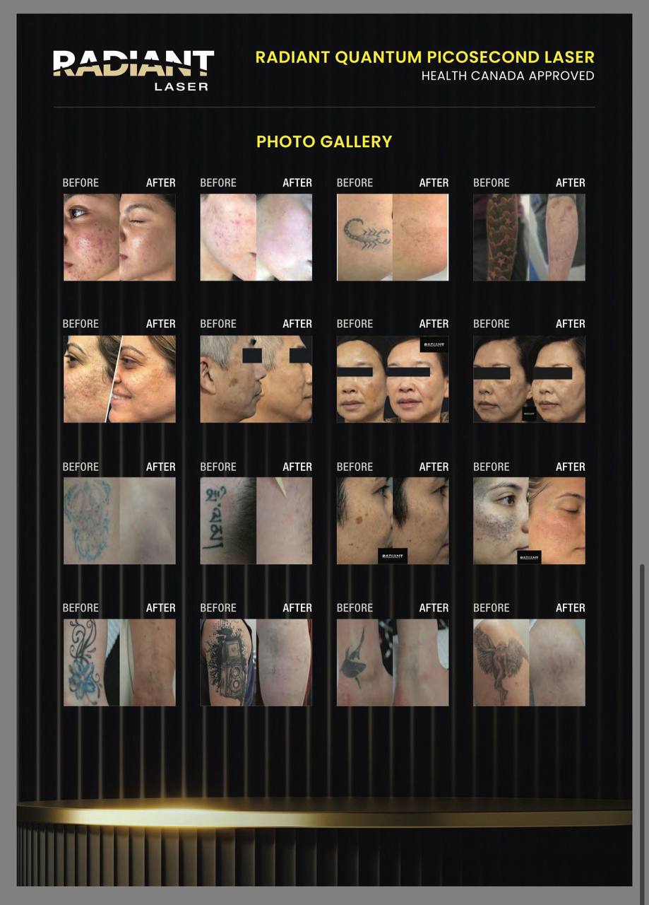 Before and after result preview
